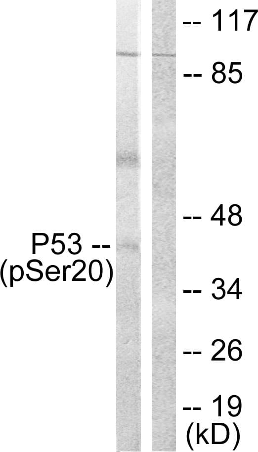 TP53 / p53 Antibody (phospho-Ser20)