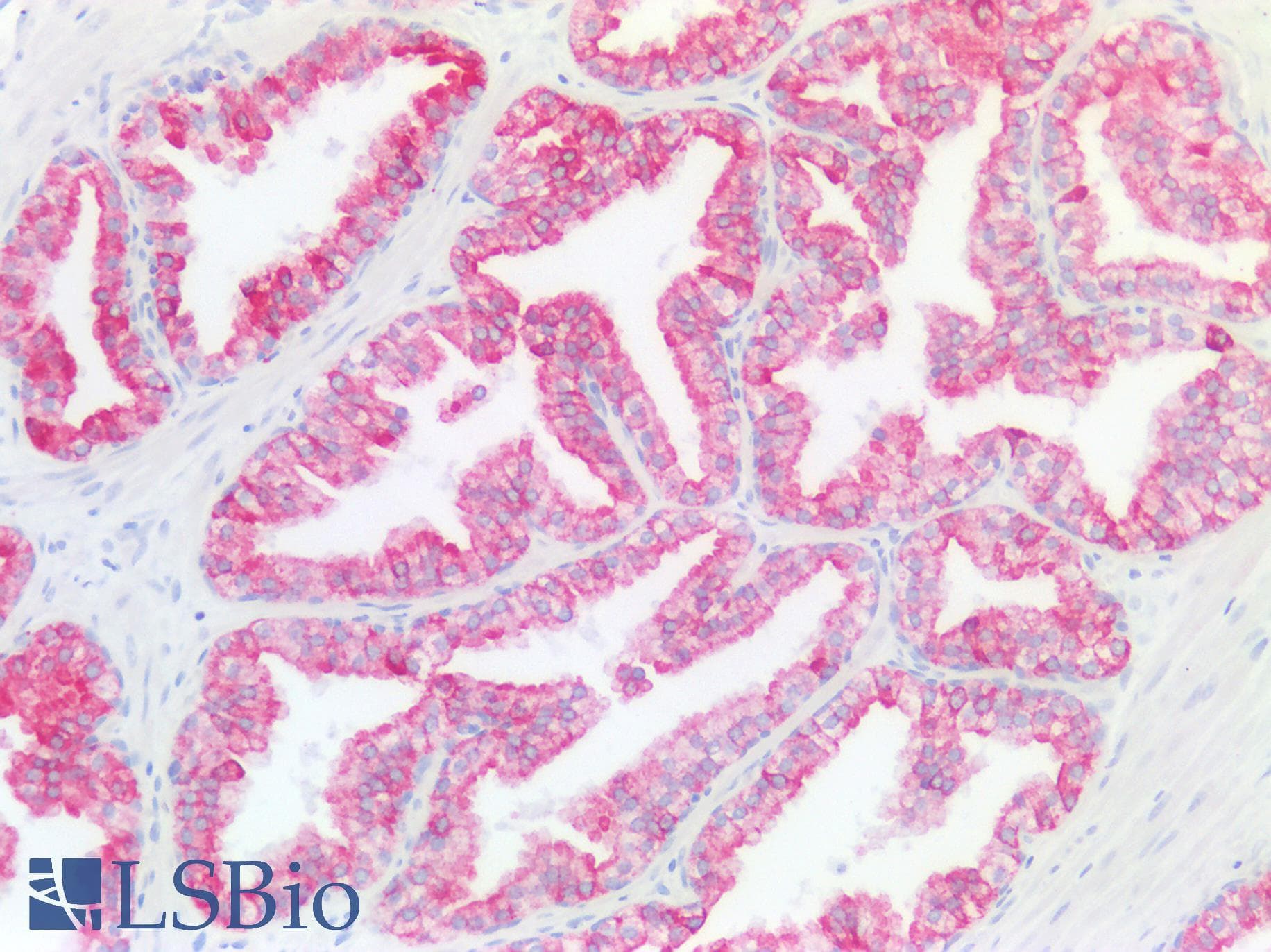 PathPlus™ KRT18 / CK18 / Cytokeratin 18 Antibody (aa48-97)