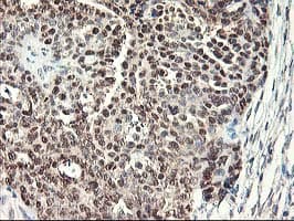 ALS2CR1 / NIF3L1 Antibody (clone OTI5A7, Carrier-free)