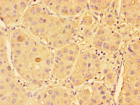 SPHK / SPHK1 Antibody