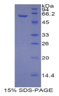 Rat REPRIMO / RPRM Protein (Recombinant His-MBP)