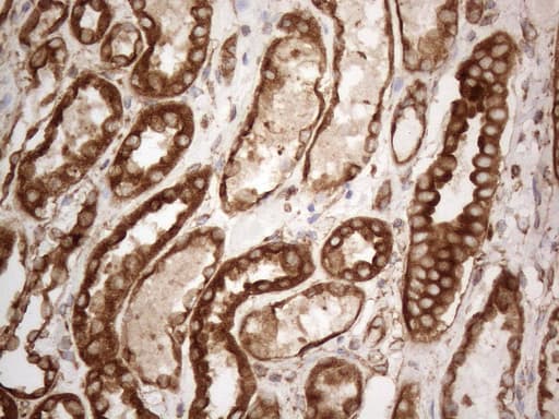 VAP33 / VAPA Antibody (aa2-227, clone OTI10E10)