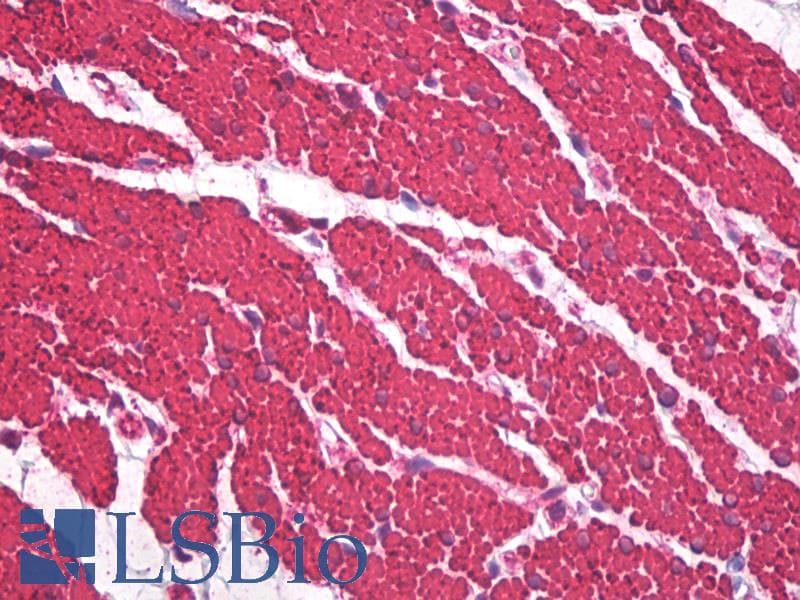IHC-plus™ Monoclonal Mouse anti-Human Muscle Actin Antibody (clone HHF35, IHC, WB)