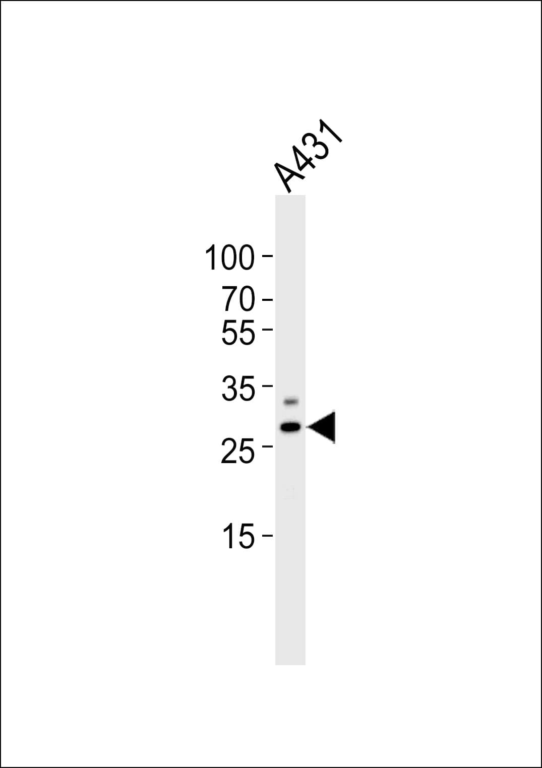 Polyclonal Rabbit anti-Human PHB / Prohibitin Antibody (aa73-107, WB)