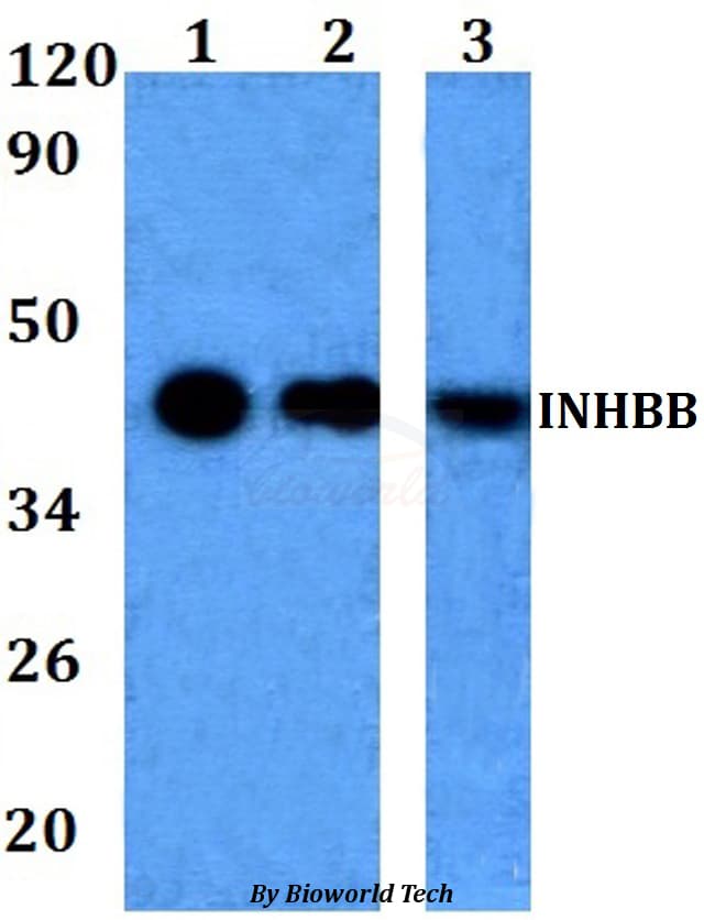 INHBB / Inhibin Beta B Antibody