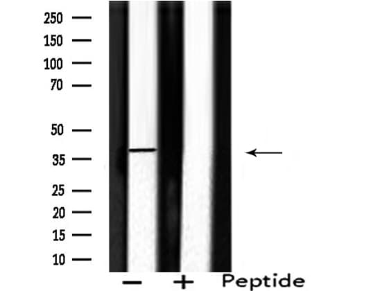 Polyclonal Rabbit anti-Human SEPT2 / Septin 2 Antibody (IF, WB)