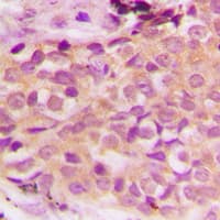 MAP3K5 / ASK1 Antibody (phospho-Ser966)