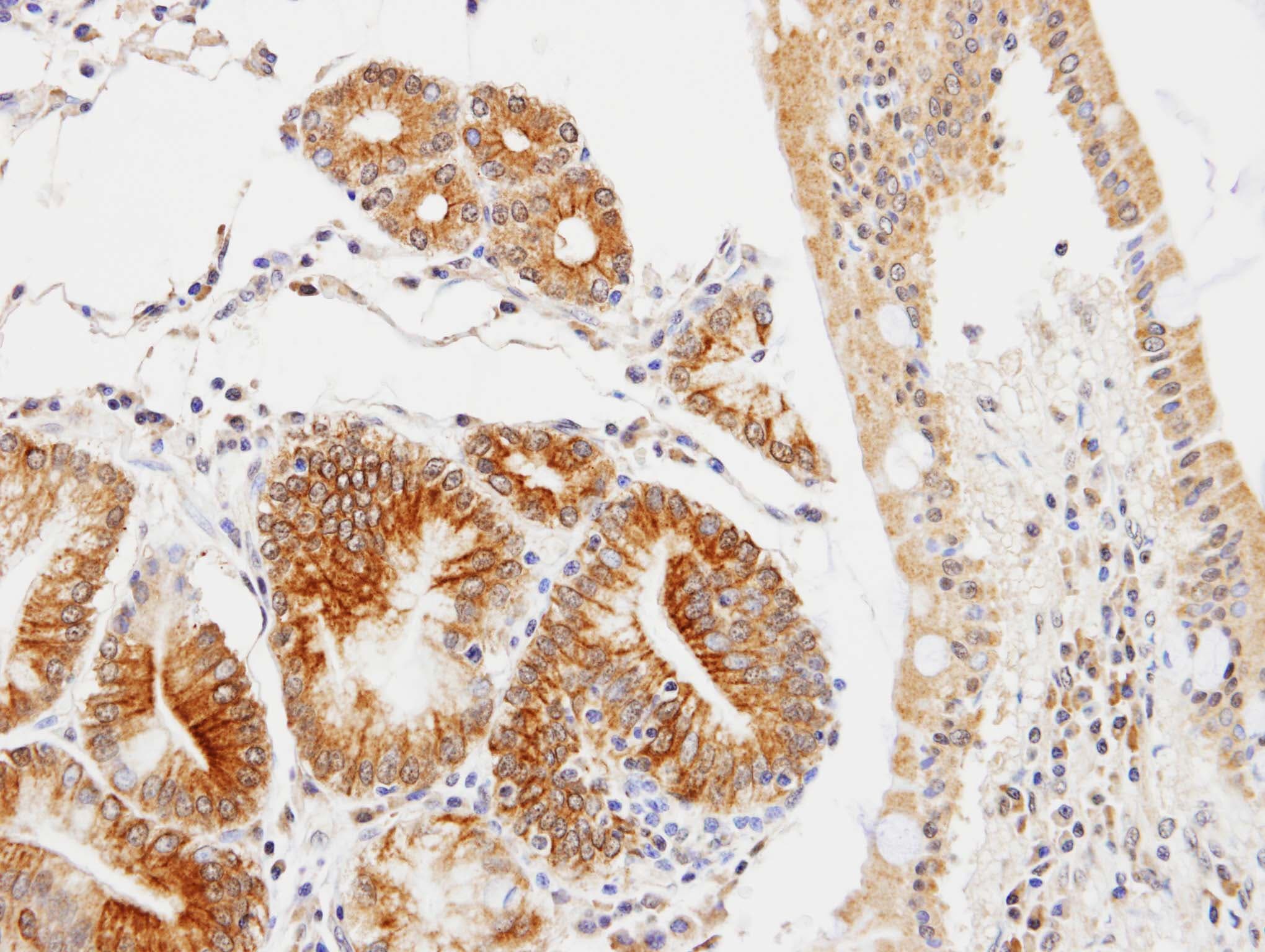 Polyclonal Rabbit anti-Human HC71 / GLOD4 Antibody (aa5-217, IHC, WB)