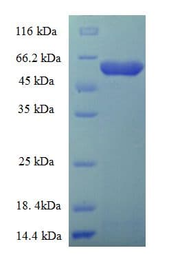 Rabies Virus gG Protein (Recombinant 6His-SUMO, N-terminus)