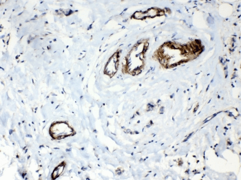 Polyclonal Rabbit anti-Human HSPB8 / H11 / HSP22 Antibody (IHC, WB)