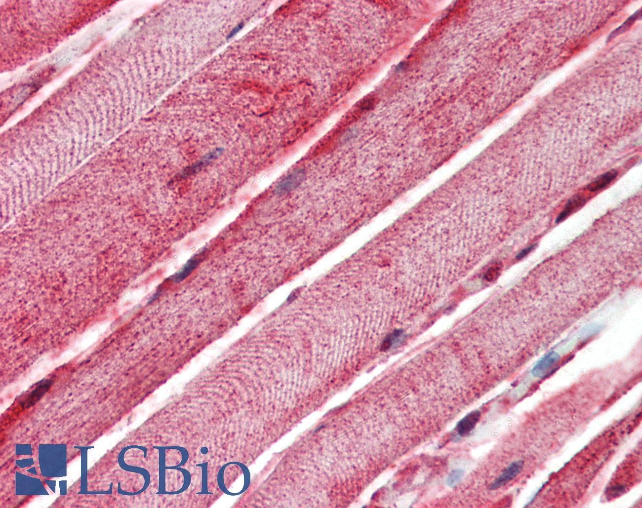 IHC-plus™ Polyclonal Rabbit anti-Human BAK1 / BAK Antibody (N-Terminus, IHC)
