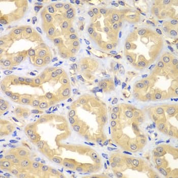Polyclonal Rabbit anti-Human ELMO3 Antibody (IHC, WB)