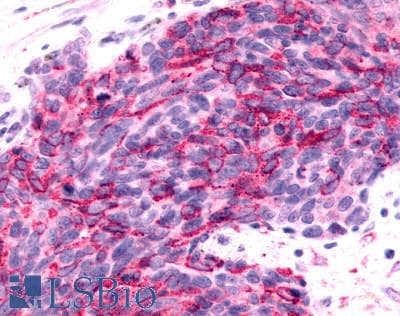 PathPlus™ ADGRB2 / BAI2 Antibody (N-Terminus)