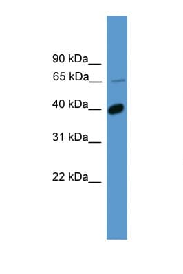 OR2B2 Antibody (aa281-330)
