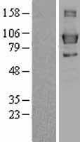 LPIN3 / Lipin-3 Protein (Over-Expression Lysate Myc-DDK (Flag))
