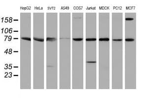 Paraplegin / SPG7 Antibody (aa300-573, clone OTI1C1)