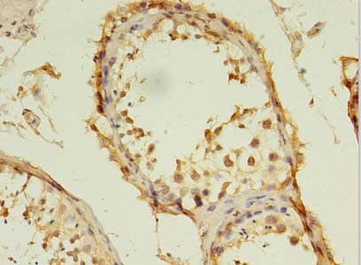 TSGA13 Antibody