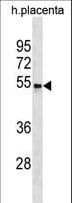 CCKAR / CCK1R Antibody (aa228-257)