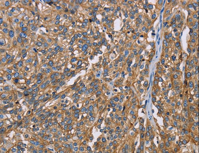 Basigin / Emmprin / CD147 Antibody