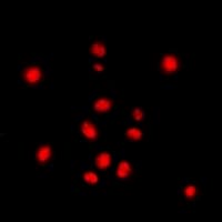 Polyclonal Rabbit anti-Human STAG3 Antibody (C-Terminus, IHC, IF, WB)