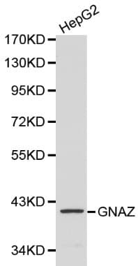 Polyclonal Rabbit anti-Human GNAZ Antibody (IHC, WB)