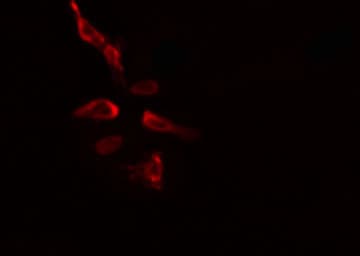 SLU7 / 9G8 Antibody