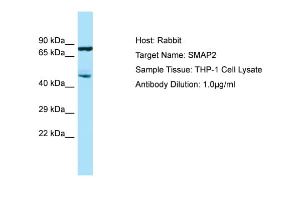 Polyclonal Rabbit anti-Human SMAP2 Antibody (aa227-276, WB)