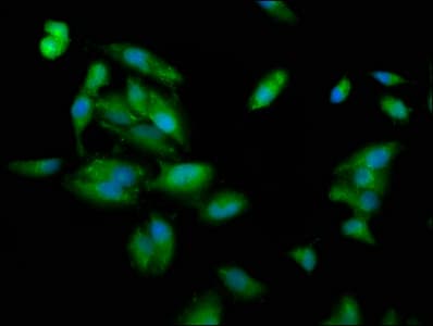 PLEC / Plectin Antibody