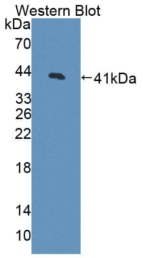 CDK2 Antibody (aa94-212, PE)