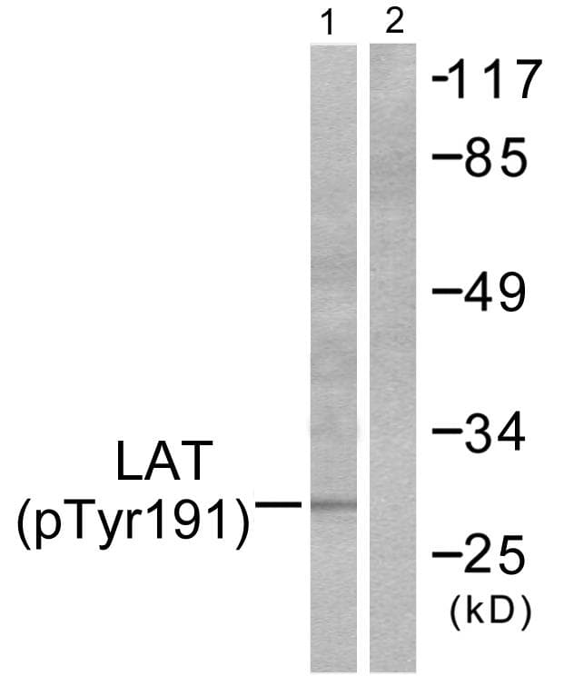 LAT Antibody (phospho-Tyr191)