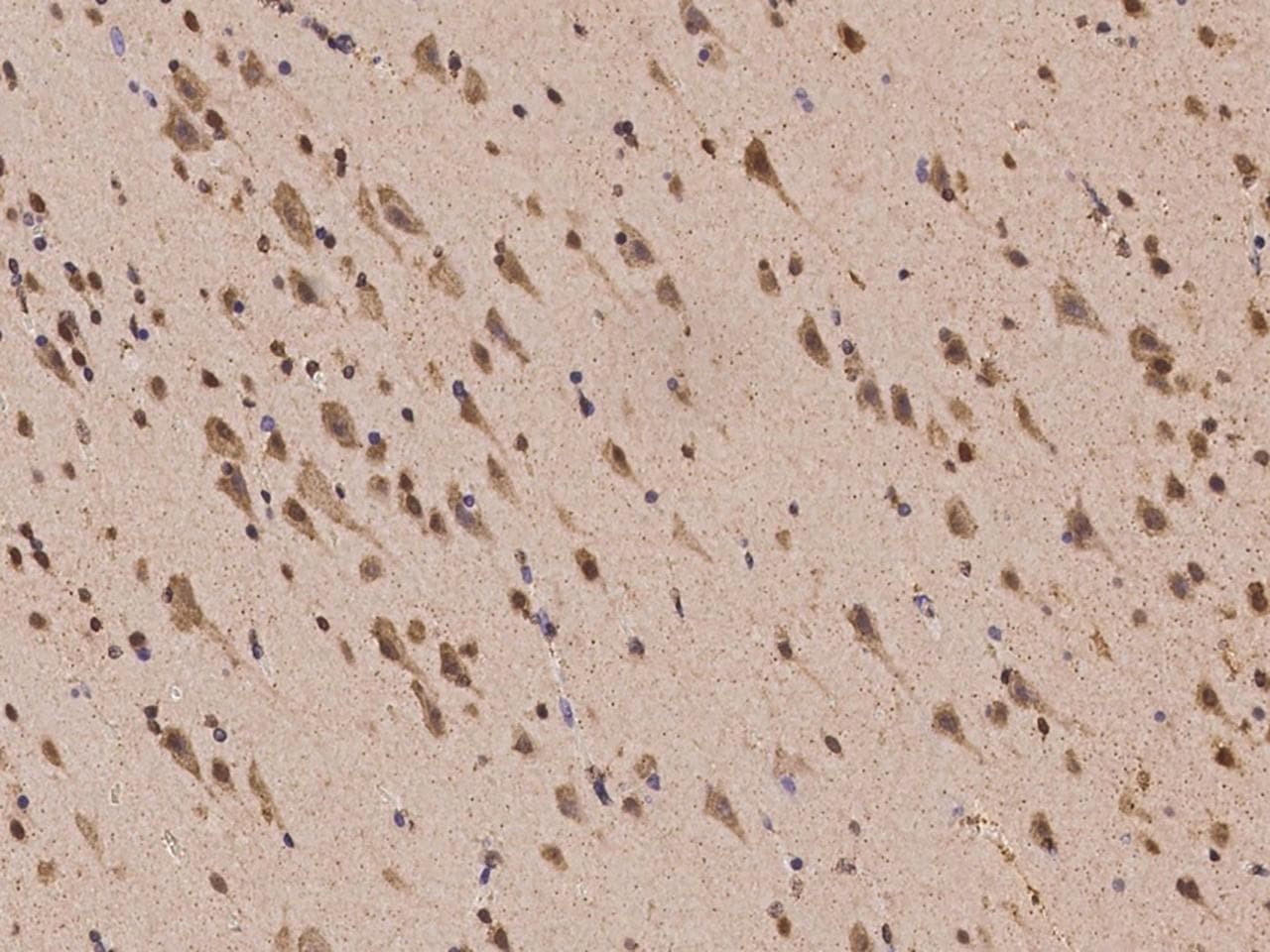 PRRC2B / KIAA0515 Antibody