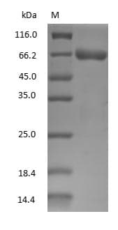 ALB / Serum Albumin Protein (Native)