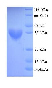 Staphylococcus aureus fabD Protein (Recombinant His)