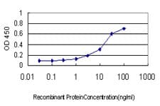 Mitofusin 2 / MFN2 Antibody (clone 4H8)