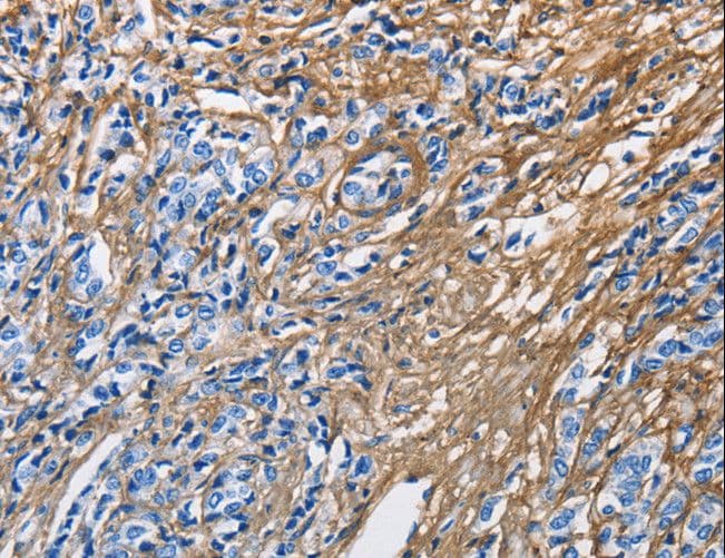 PathPlus™ COL3A1 / Collagen III Antibody