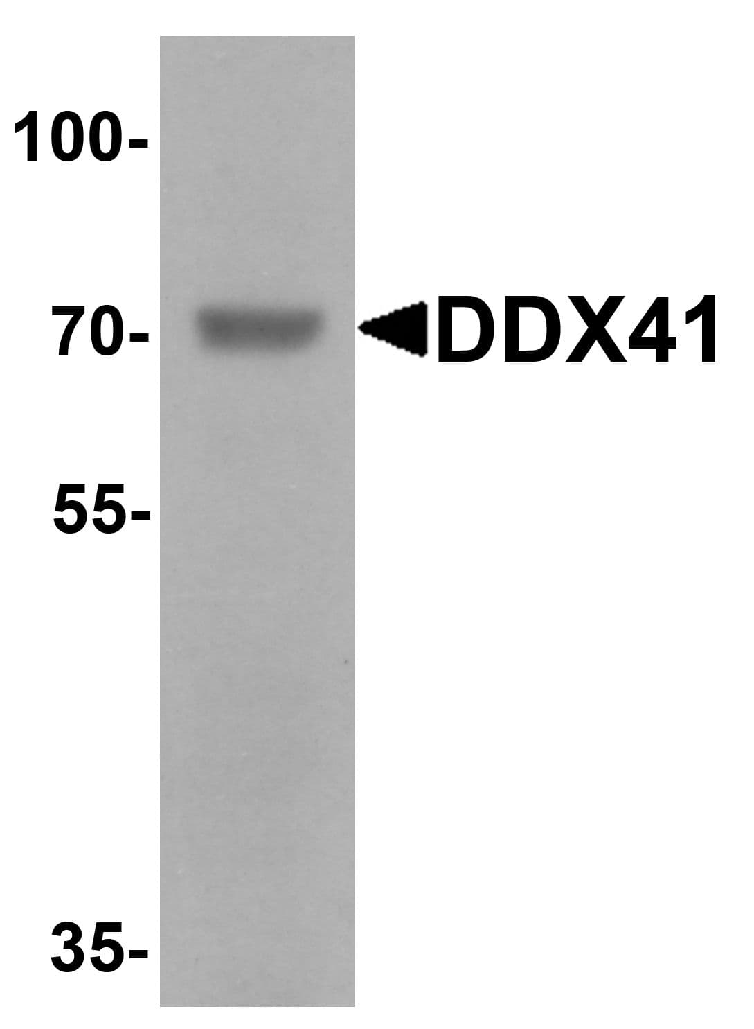DDX41 / ABS Antibody