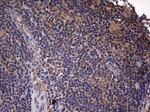 IL1RN Antibody (clone OTI2B1)