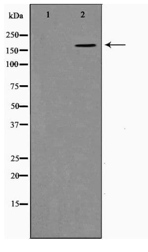Polyclonal Rabbit anti-Human COL11A1 / Collagen XI Alpha 1 Antibody (WB)