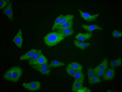 RIPK1 / RIP Antibody