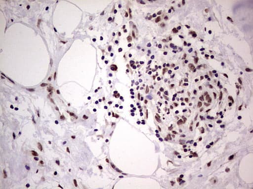 LPIN1 / Lipin 1 Antibody (clone OTI1B7, Carrier-free)