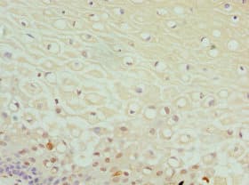 Dipeptidyl Peptidase 3 / DPP3 Antibody