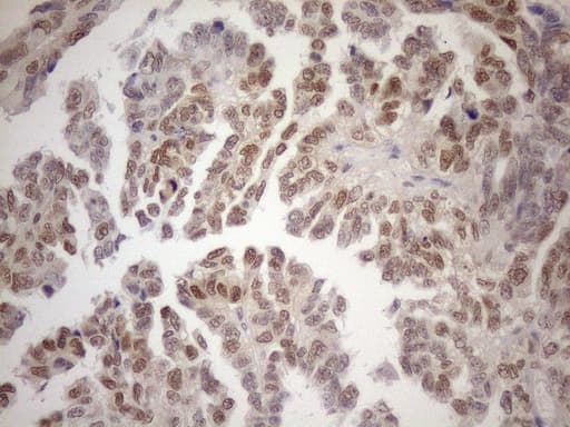 Monoclonal Mouse anti-Human MGMT Antibody (clone OTI2F10, Carrier-free, IHC, WB)