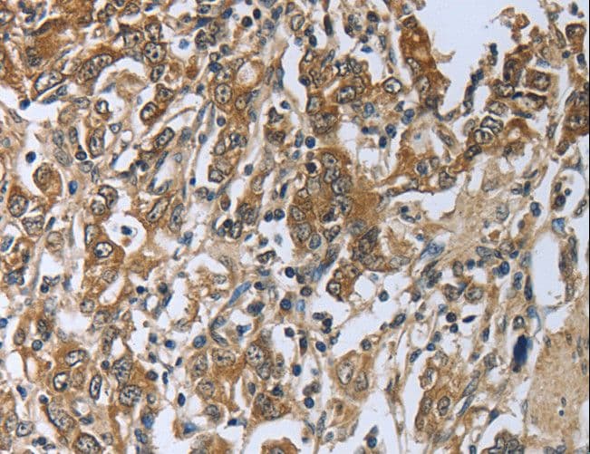 Polyclonal Rabbit anti-Human PRL / Prolactin Antibody (IHC)