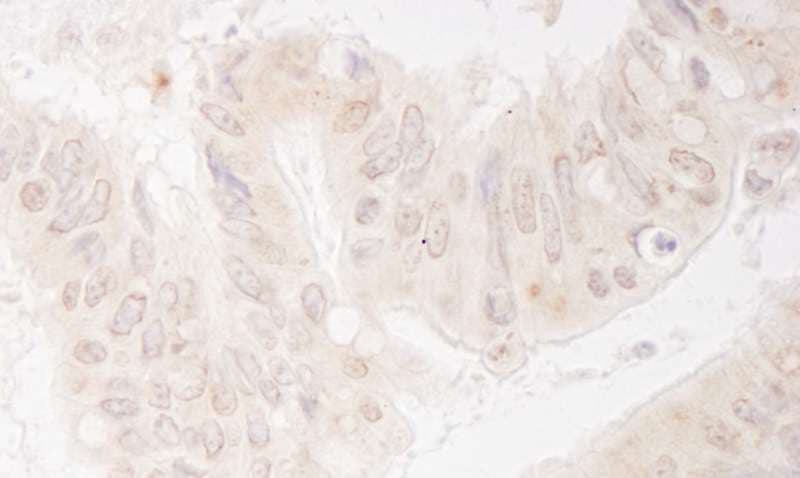KIF14 Antibody (aa900-950)