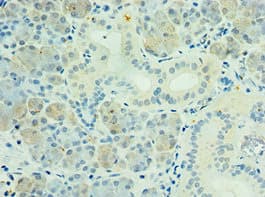 Polyclonal Rabbit anti-Human PAK6 Antibody (aa1-270, IHC)