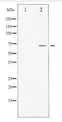 FOXO1 / FKHR Antibody