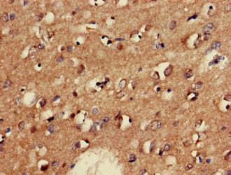 GAD65 Antibody