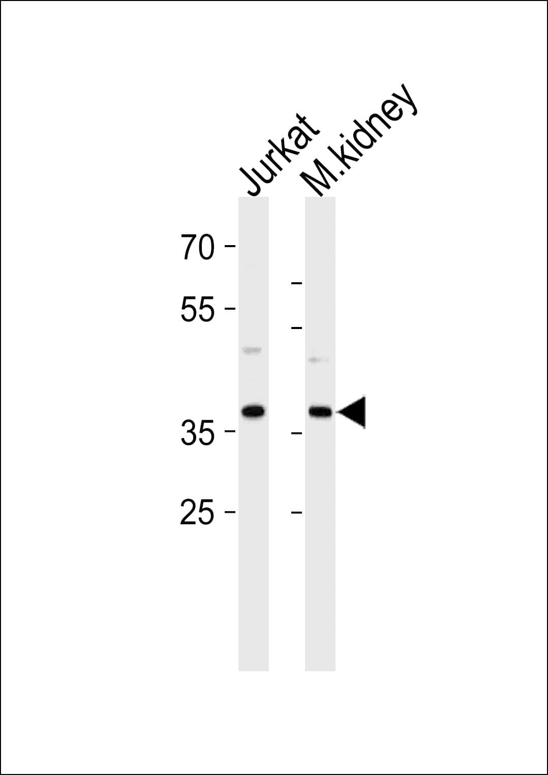 MAPK14 / p38 Antibody (Tyr323)