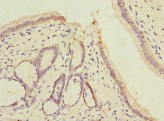 VARS / ValRS Antibody