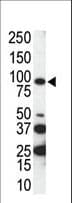 AXL Antibody (aa863-894)